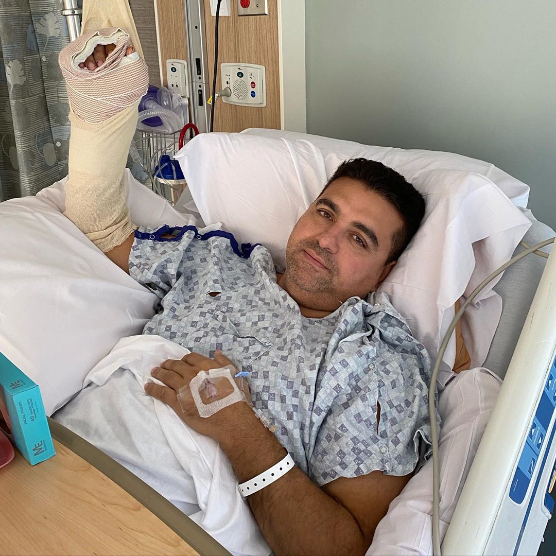 Buddy Valastro es operado tras sufrir un accidente en su mano