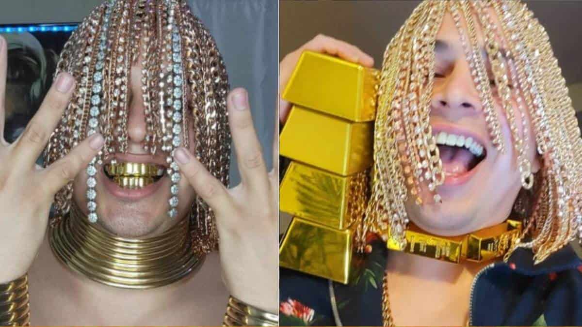Dan Sur The Rapper Who Claims To Have Gold Chain Implants For Hair Videos