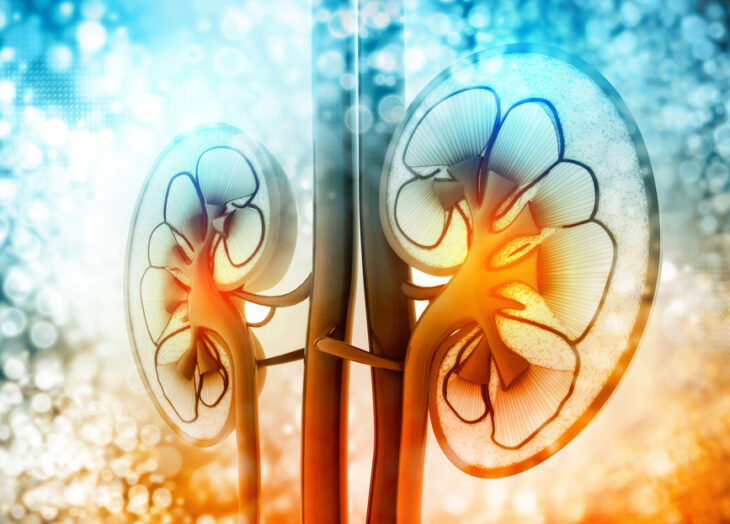 trasplante de riñón