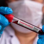 Identifican al “paciente cero” de hantavirus