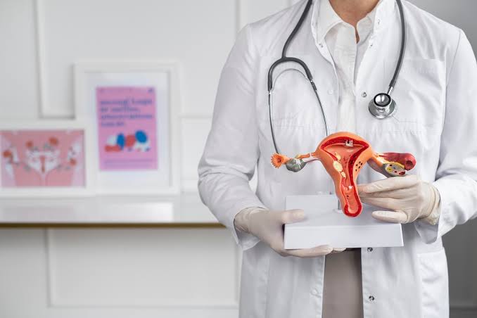 Cáncer de Ovario