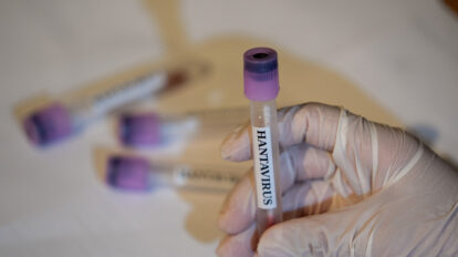Francia hantavirus
