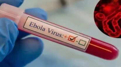 Venezuela mantiene vigilancia epidemiológica ante el virus del ébola