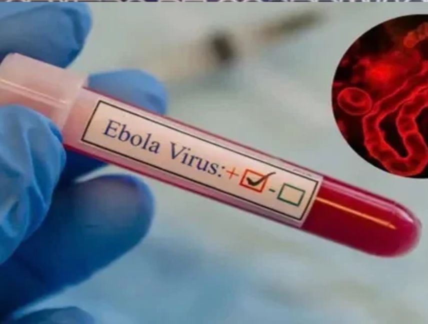 Venezuela mantiene vigilancia epidemiológica ante el virus del ébola