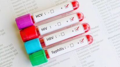 Incremento de infecciones de transmisión sexual en adolescentes venezolanos