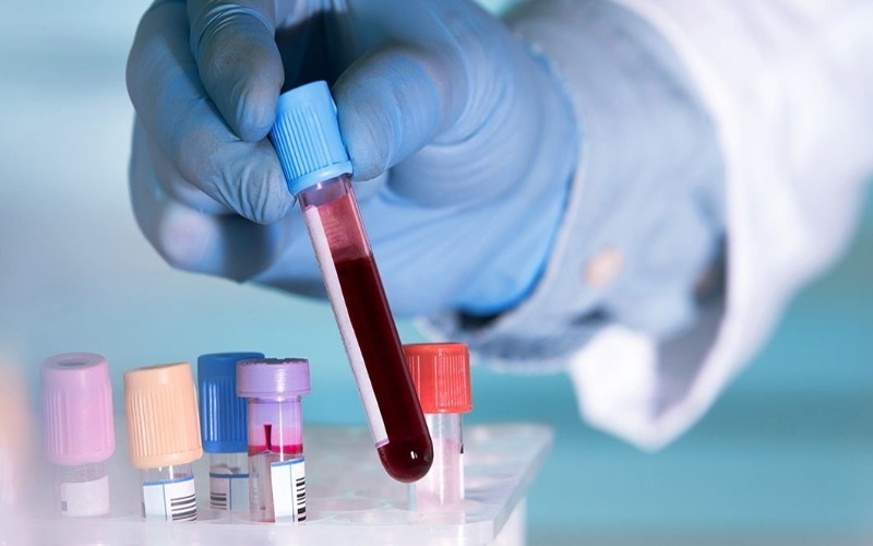 Desarrollan test para detectar cáncer de páncreas con muestra de sangre