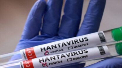 Confirman 3 fallecidos por Hantavirus en Anzoategui