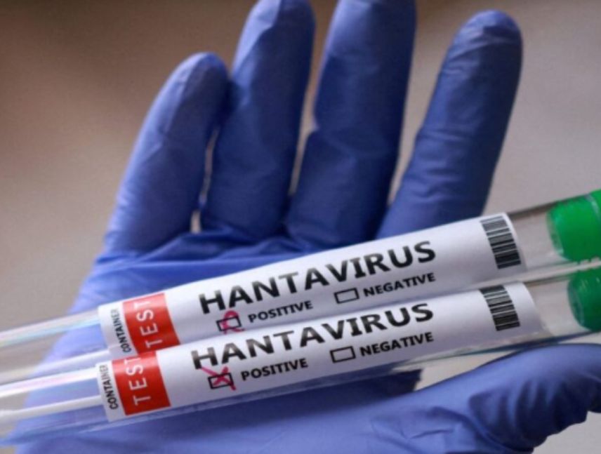 Confirman 3 fallecidos por Hantavirus en Anzoategui