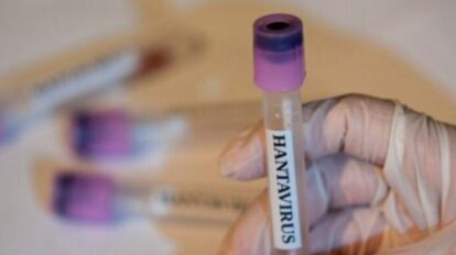 Baja probabilidades de contagio de hantavirus en Caracas.