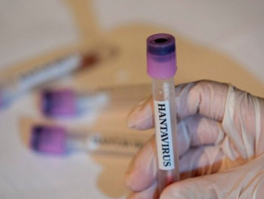 Baja probabilidades de contagio de hantavirus en Caracas.