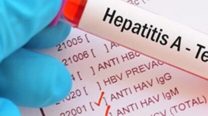OMS en alerta por aumento de muertes por hepatitis a nivel mundial.