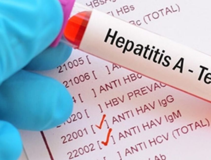 OMS en alerta por aumento de muertes por hepatitis a nivel mundial.