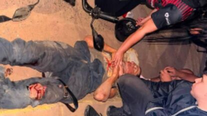 accidente de moto en Villa Upata