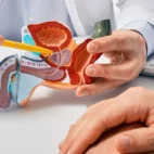 Hallan nuevas pistas clave sobre el cáncer más común entre los hombres