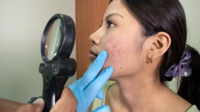 Sociedad dermatológica rechaza contenido de influencers sobre área de salud
