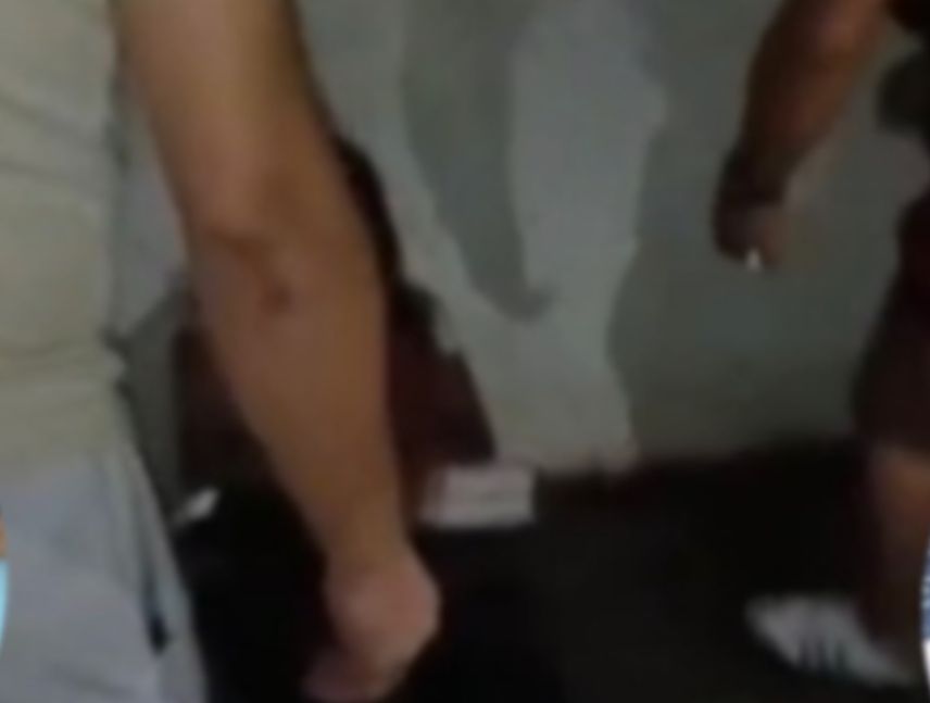 ataque con machete en Cojedes