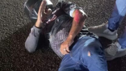 Herido motorizado tras colisión en la avenida Atlántico
